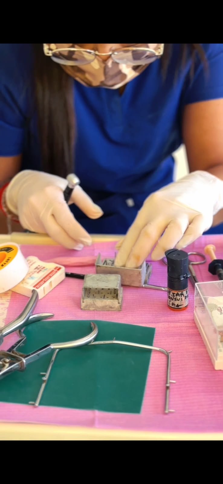 Tratamiento de blanqueamiento dental en proceso